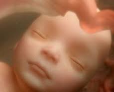 Revivance prénatale